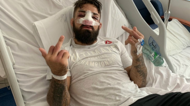 Mike Perry si po drsné zlomenině nosu dlouho nezabojuje