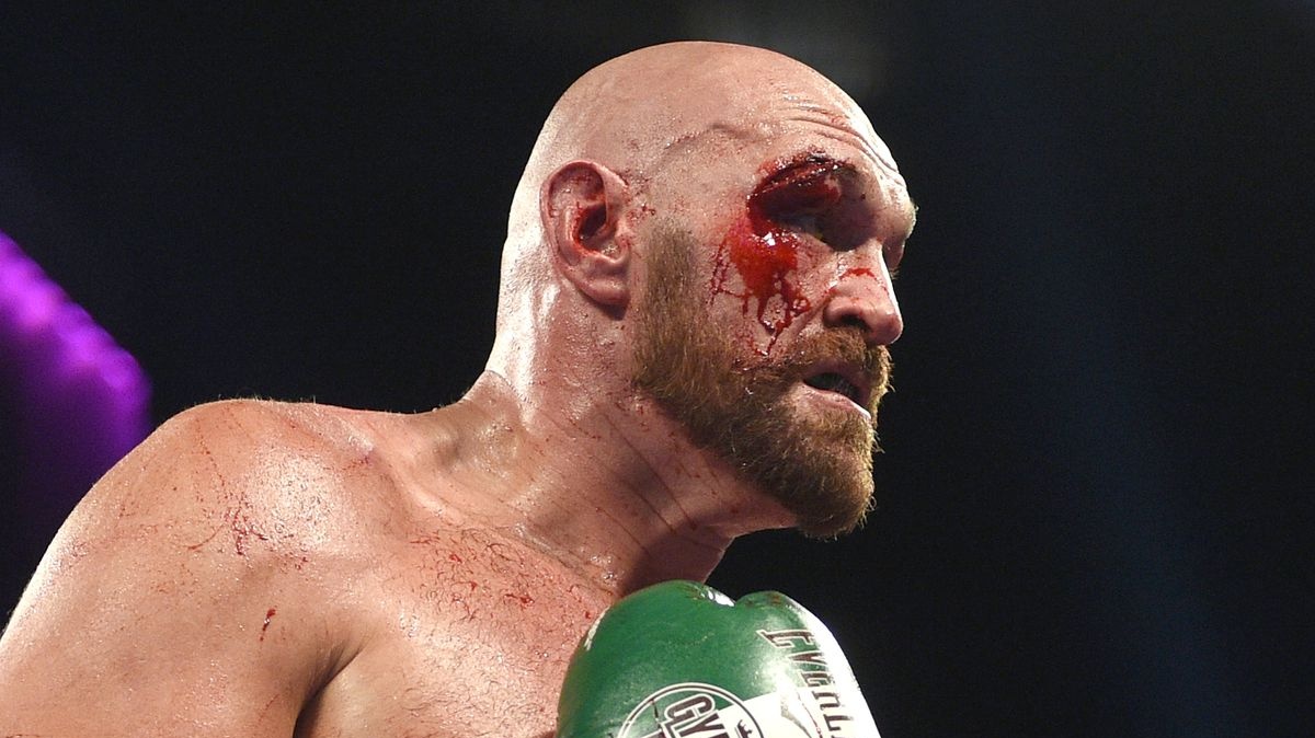 Těsně před životním zápasem Tyson Fury přiznal, že bojuje s depresemi