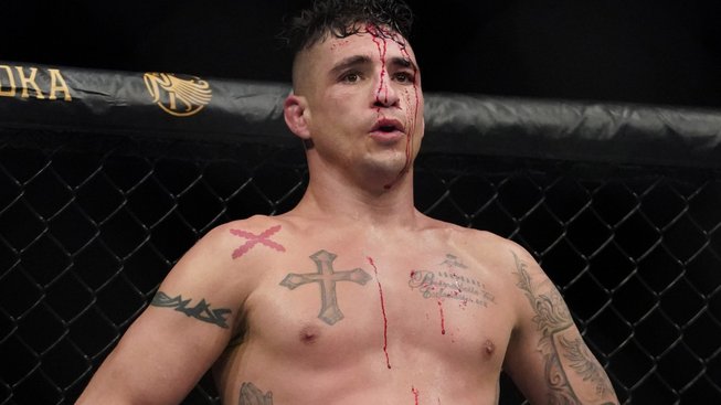 „Noční můra“ v UFC skončila. Nejdéle sloužící bojovník Diego Sanchez byl vyhozen za podivných okolností