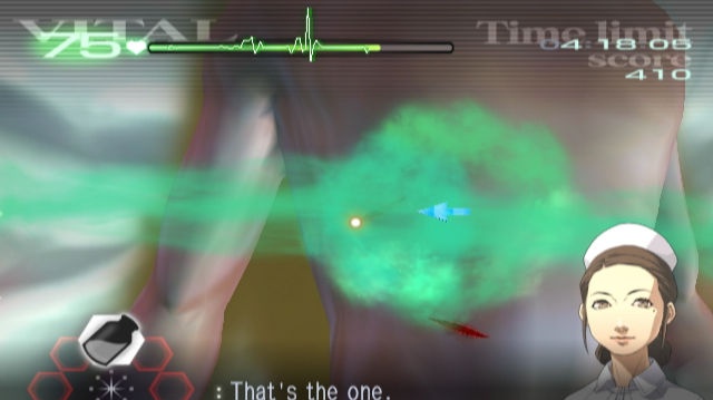 Trauma Center: Second Opinion - recenze