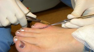 Za loňský rok eviduje Pojišťovna České spořitelny nárůst pojistných událostí o 22 %