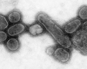 Prasečí chřipka - nejistota pro ekonomiky vyspělých států?