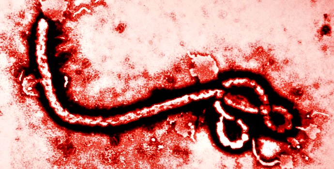 Ebola neexistuje? 4 konspirační teorie na internetu trápí zdravotnické organizace