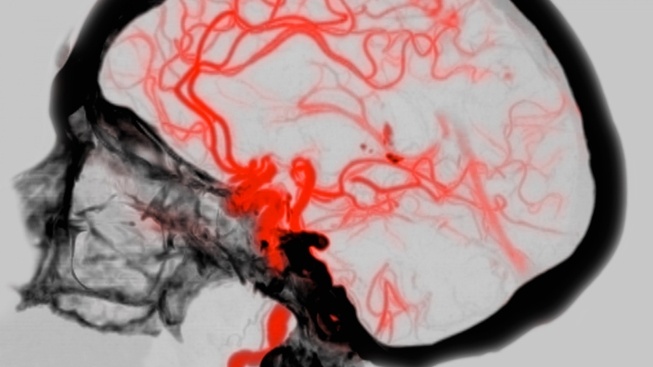 Opravdu používáme jen 10 procent mozku?