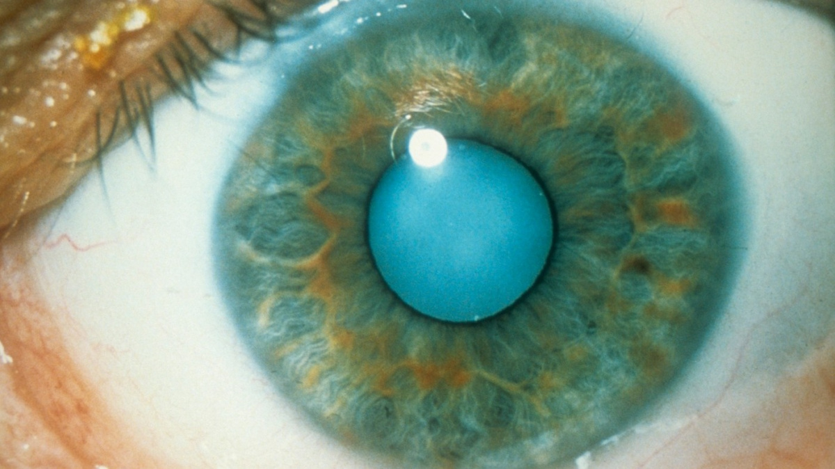 Podívejte se na úžasné optické iluze