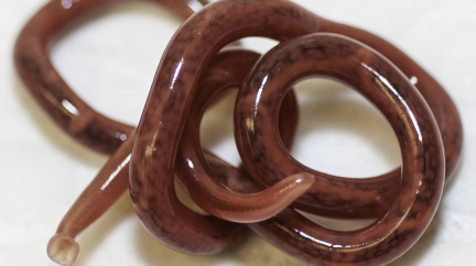 Čeští lékaři našli v těle pacientky unikátního parazita