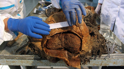 Tělesný tuk může zakonzervovat mozek na celá tisíciletí