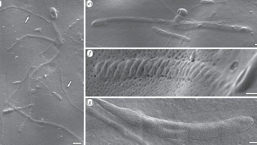 Vědci našli spermie staré 50 milionů let. Patří příbuzným žížal
