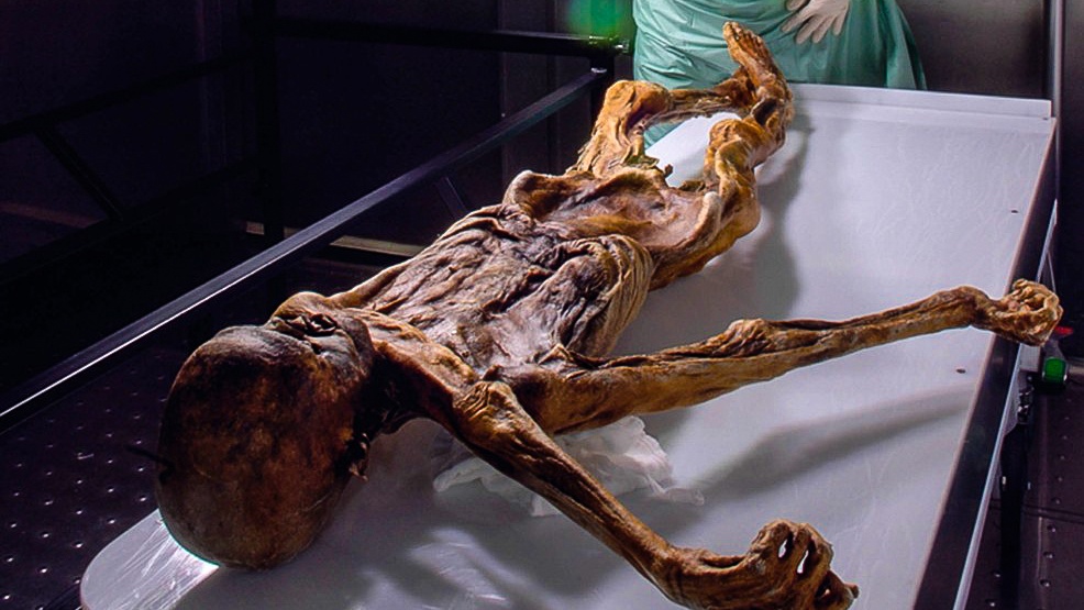 Ötziho bolesti břicha vrhají nové světlo na osídlování Evropy