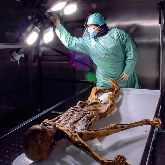 Ötziho bolesti břicha vrhají nové světlo na osídlování Evropy