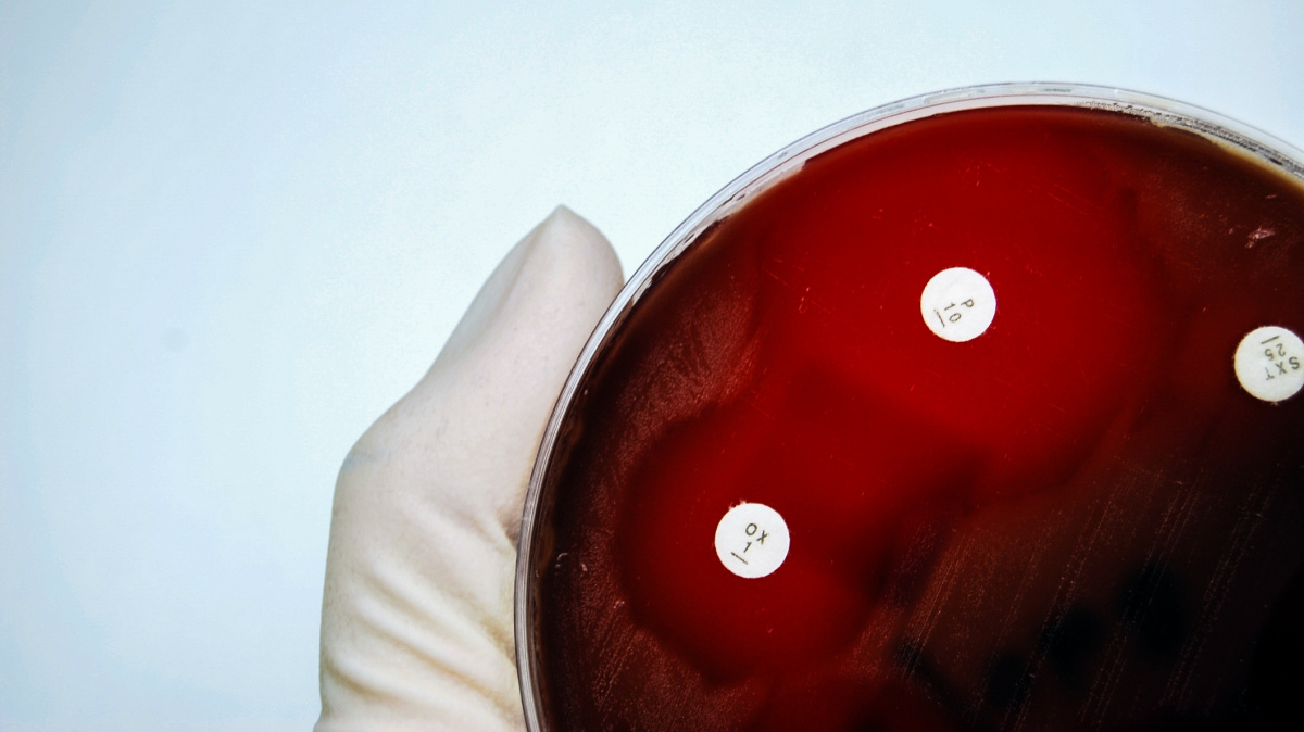 Přijde bakteriální apokalypsa? Pár 'zbraní' ještě máme, vývoj antibiotik ale vázne