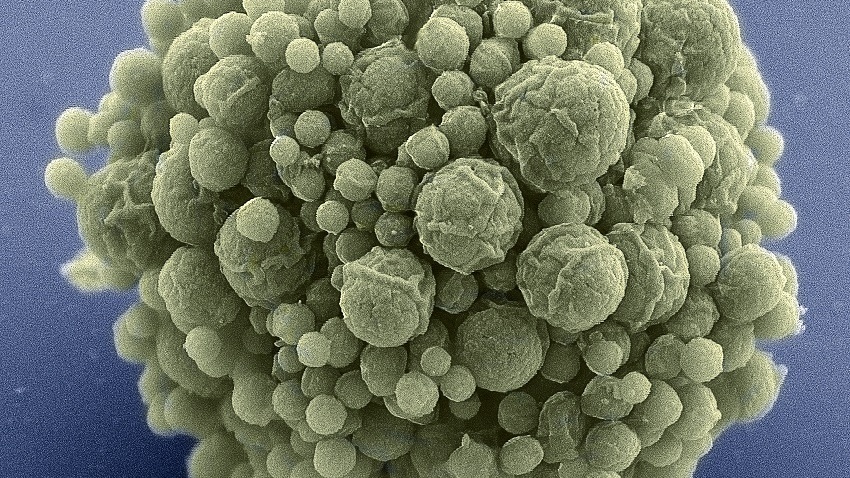 Slavný vizionář vytvořil umělý organismus jen s 473 geny. Budeme brzy vyrábět bakterie 'na míru'?