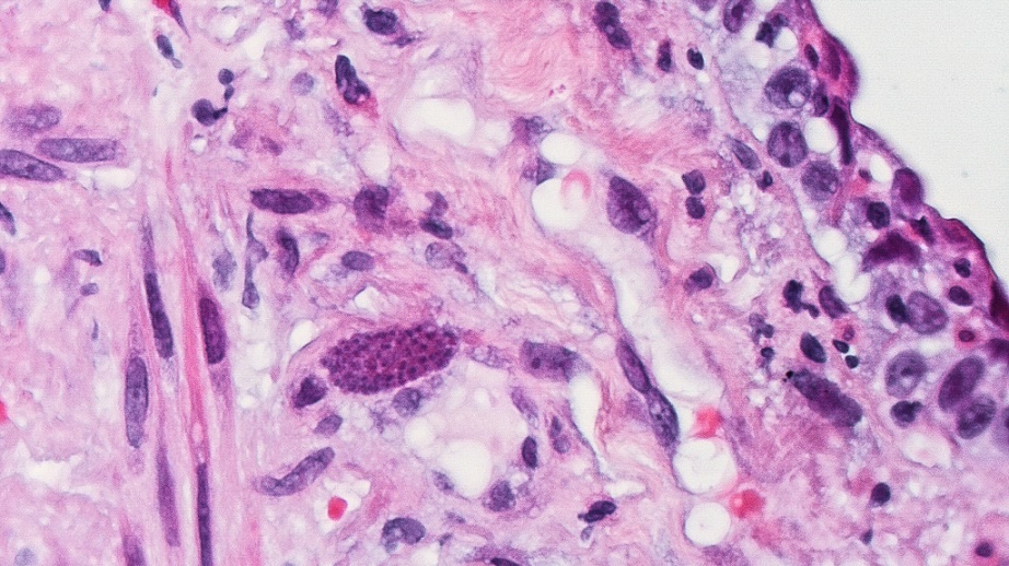 Vše, co jste kdy chtěli vědět o toxoplazmóze, ale báli jste se zeptat