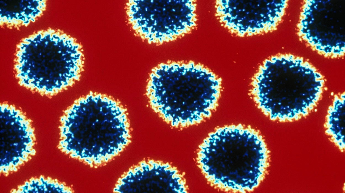 Budou ochočené viry léčit rakovinu?