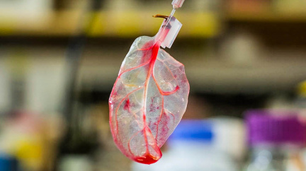 Srdce ze špenátu: Vědci využili rostlinu k 'výrobě' srdeční tkáně