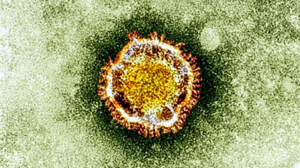 SARS, MERS a další hrozby: Vědci se snaží zabránit další pandemii