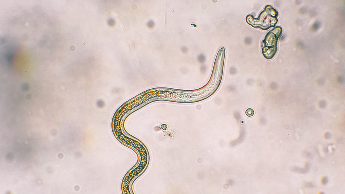 Škrkavka jako nečekaný pomocník: Svým hostitelům likviduje tukové zásoby