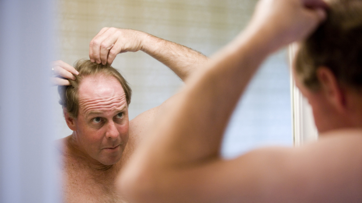 Za plešatění mohou oba rodiče, nikoli jen geny z matčiny strany