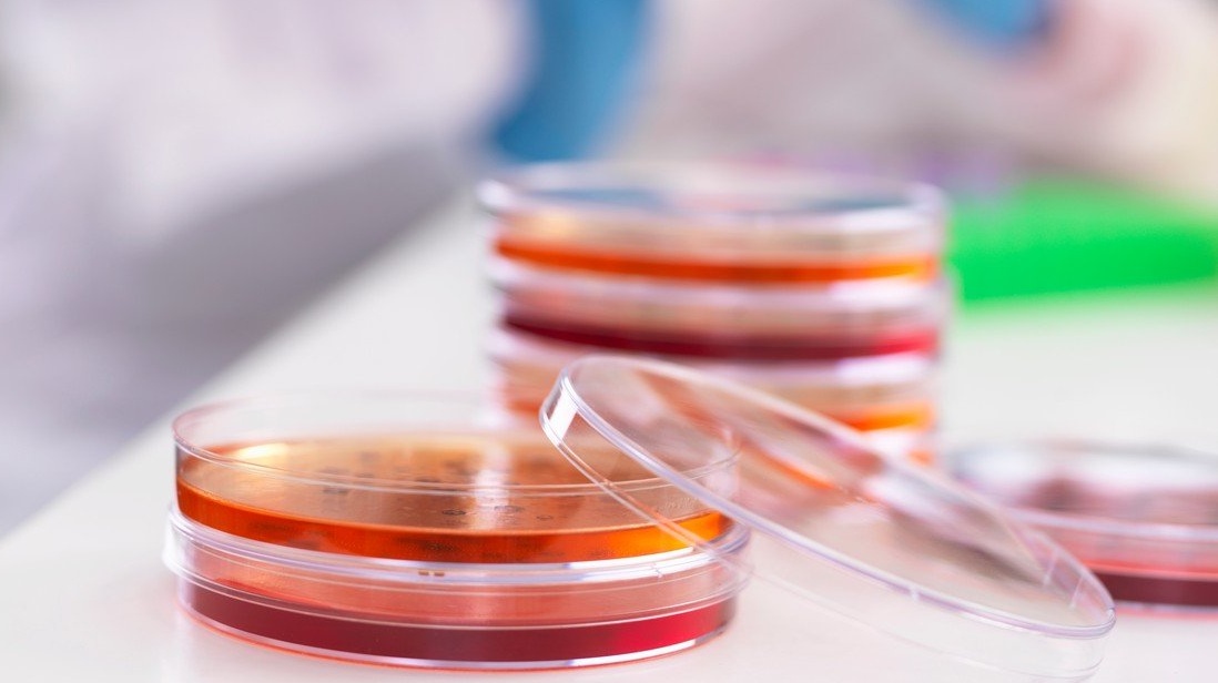 Nový test odhalí všechny známé bakteriální infekce najednou