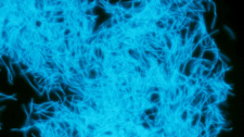 4.DCO-methanobacterium_sp
