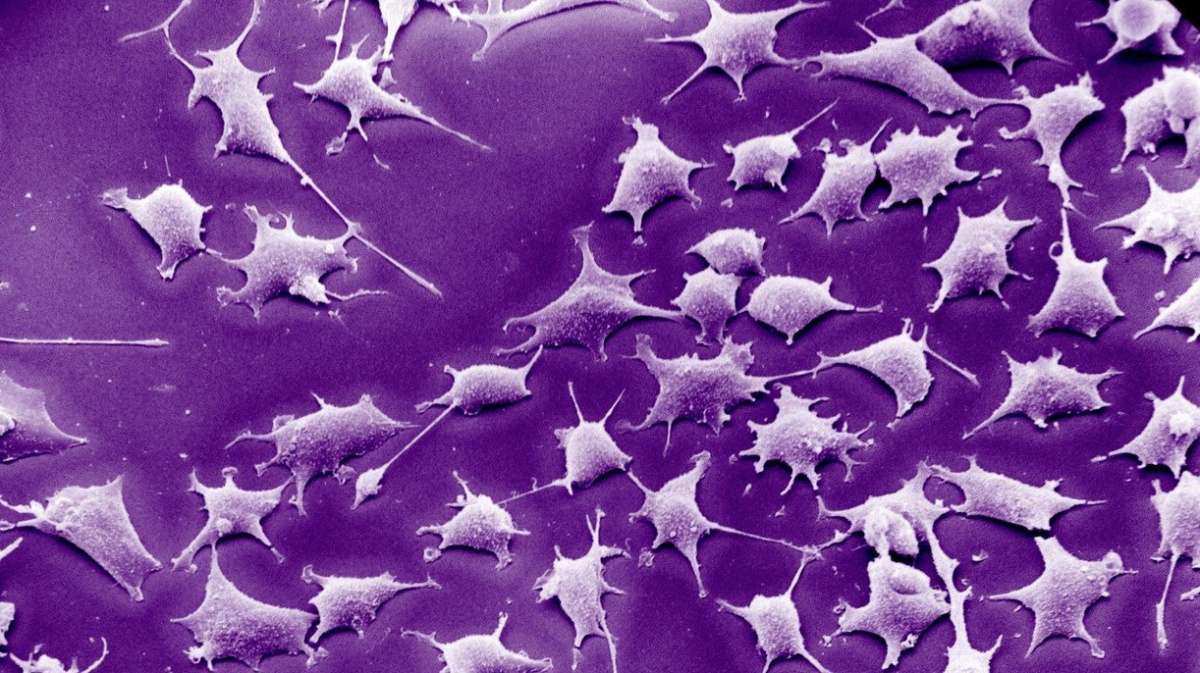 Přeprogramované kožní buňky vyrážejí do boje s rakovinou