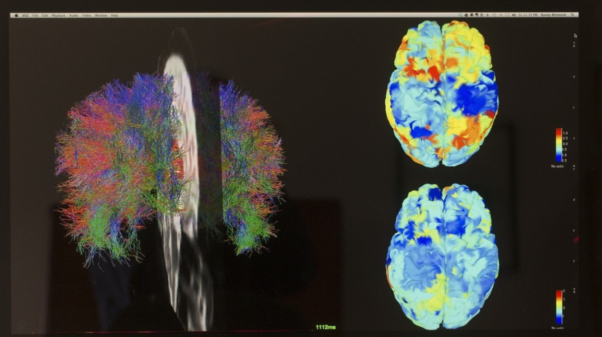 Odhalili jsme v mozku vzorce lidského vědomí, hlásí vědci