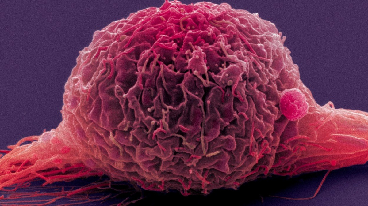 Jediný lék úspěšně léčí šest různých typů nádorů