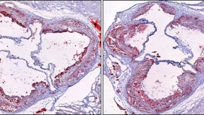 Plak u myši se zdravým spánkem (nalevo) vs. chronicky nevyspalé myši (napravo)