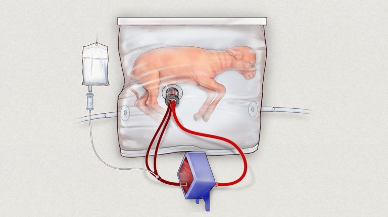 Umělá děloha prošla testy na zvířatech, dává šanci předčasně narozeným dětem