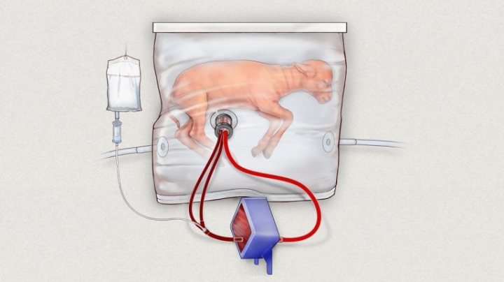 Umělá děloha prošla testy na zvířatech, dává šanci předčasně narozeným dětem