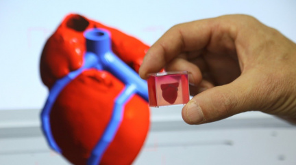 První 3D biotisknuté srdce slibuje pokrok na poli transplantátů
