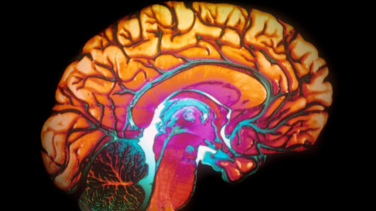 Sto hodin trvající MRI pořídila zatím nejdetailnější 3D obrázek mozku