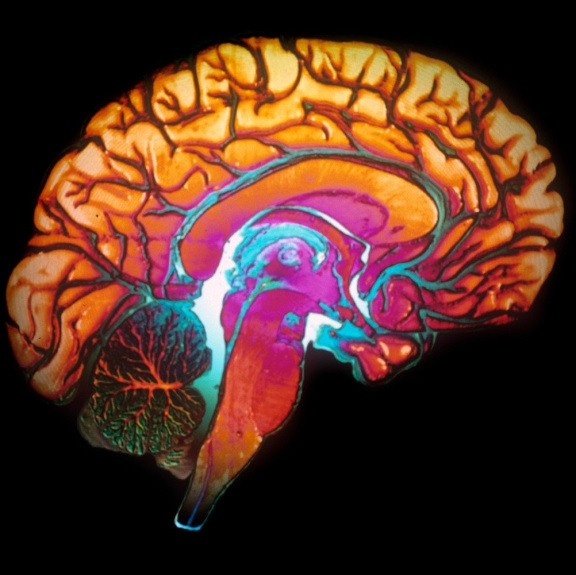 Sto hodin trvající MRI pořídila zatím nejdetailnější 3D obrázek mozku