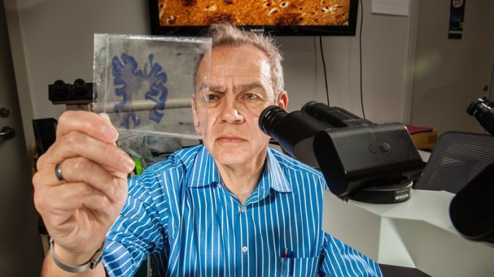 Mozky vrahů jsou jiné. Mají míň šedé kůry