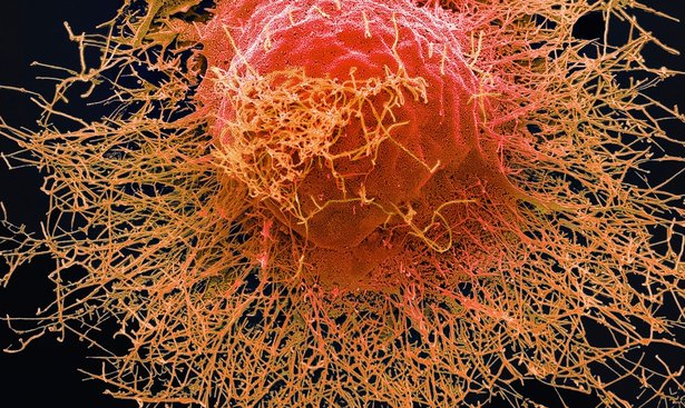 profimedia-0389535096flucell