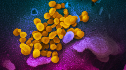 Smrtící krása: Koronavirus poprvé zblízka na snímcích z mikroskopu