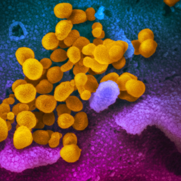 Smrtící krása: Koronavirus poprvé zblízka na snímcích z mikroskopu