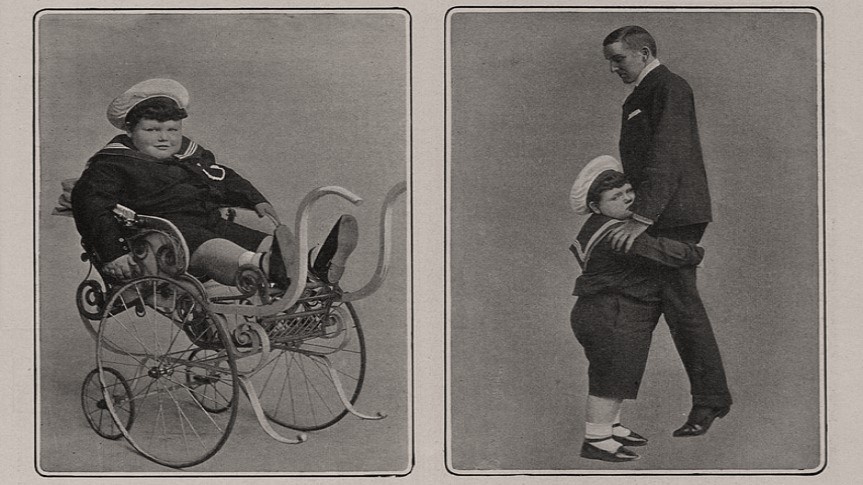 S obezitou předčasně zestárnete