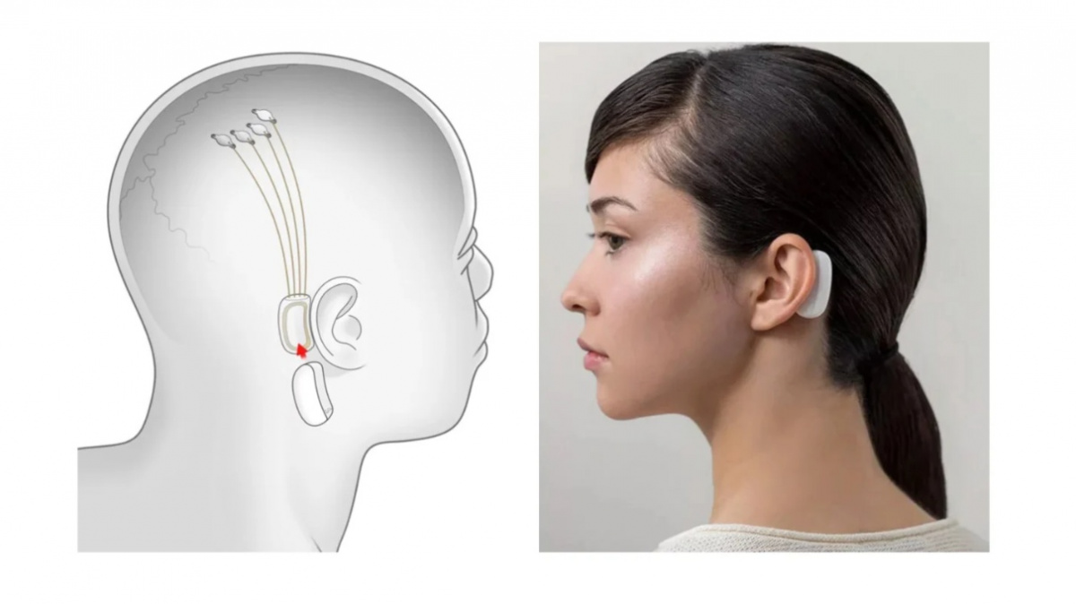 Počítač i telefon ovládnete elektrodami v mozku