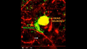microglia