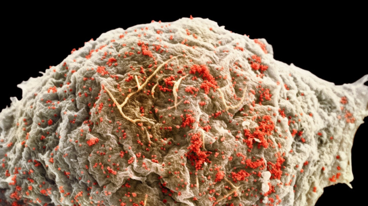 Američané mění pravidla hry, schválili přelomovou injekci proti HIV