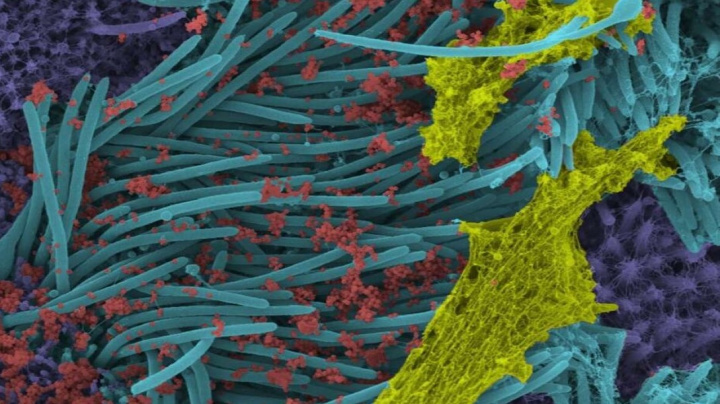 Koronavirus se zběsile množí. Dokazují to nové snímky