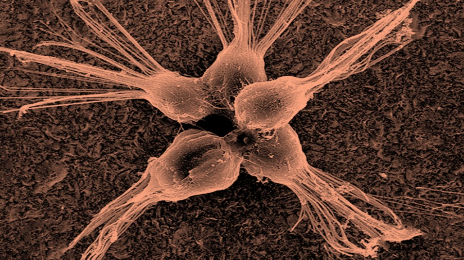 Objeven první organismus, který požírá viry. Bon appétit!