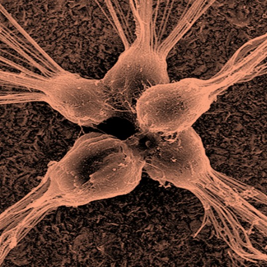 Objeven první organismus, který požírá viry. Bon appétit!