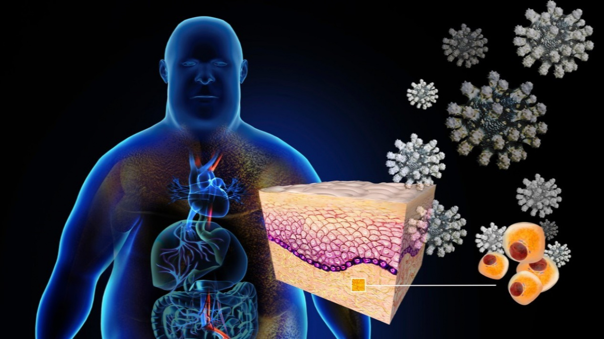 Nejvíc obětí covidu mají země s vysokým počtem obézních, tedy i Česko