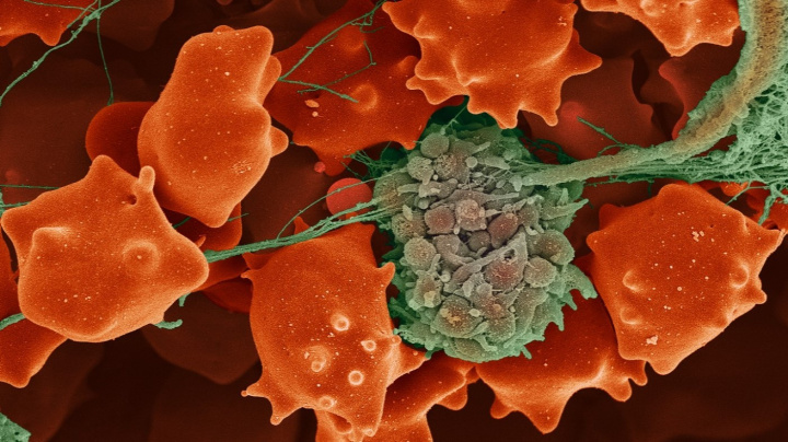 Vědci zjistili, proč vakcína AstraZeneca může způsobit krevní sraženiny