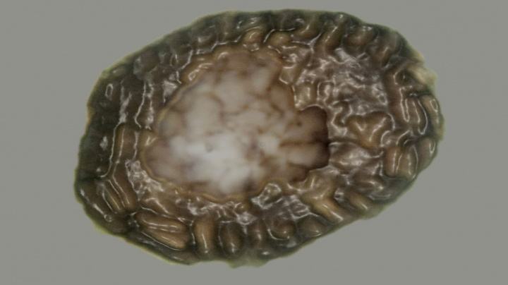 Nalezena nejstarší fosilie mnohobuněčného předka živočichů včetně člověka