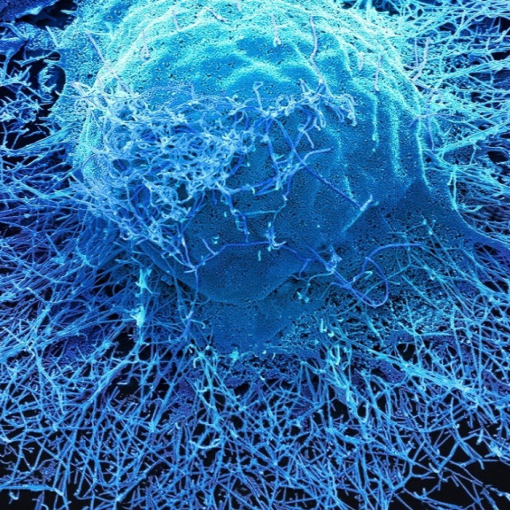 Koronavirus řádil hlava nehlava, patrně vyhubil dva kmeny chřipky