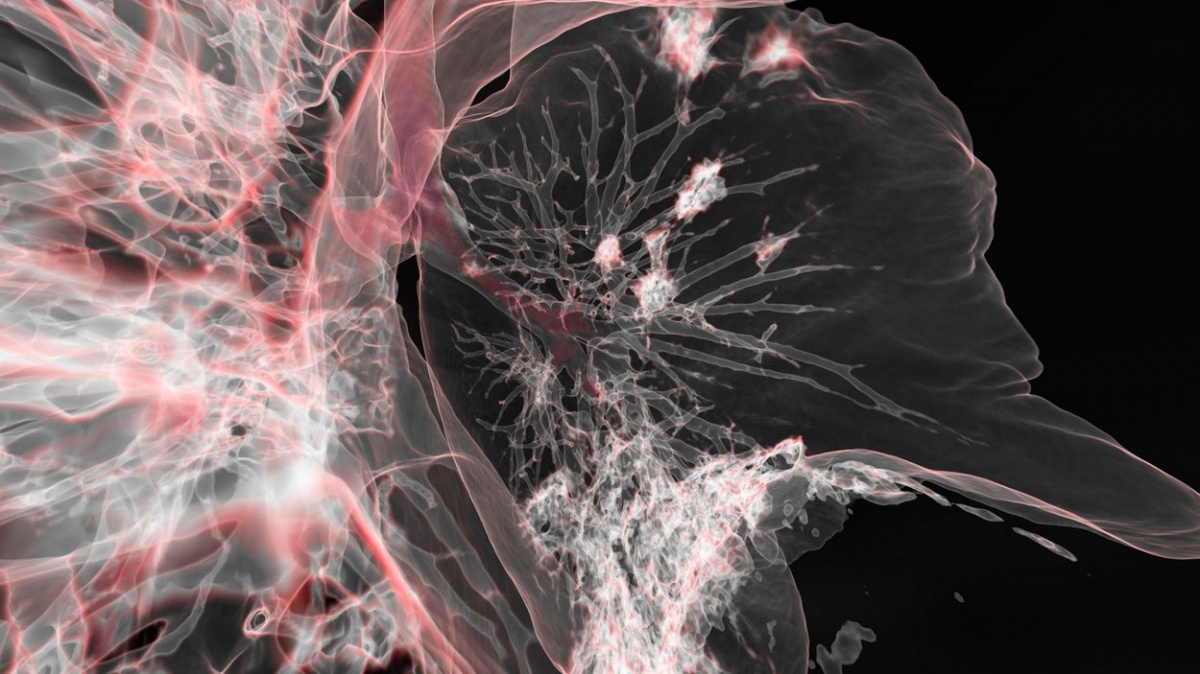 První případ covidu se patrně vyskytl už 17. listopadu 2019