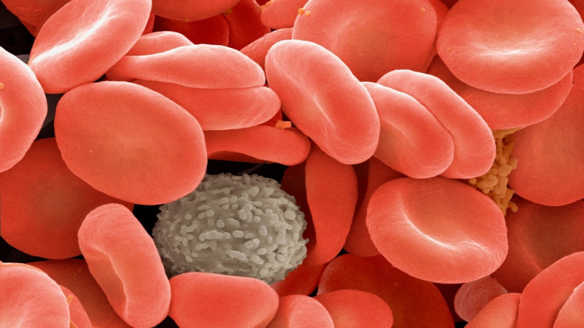 Covid vyvolává změny v krvi, které mohou leccos vysvětlit